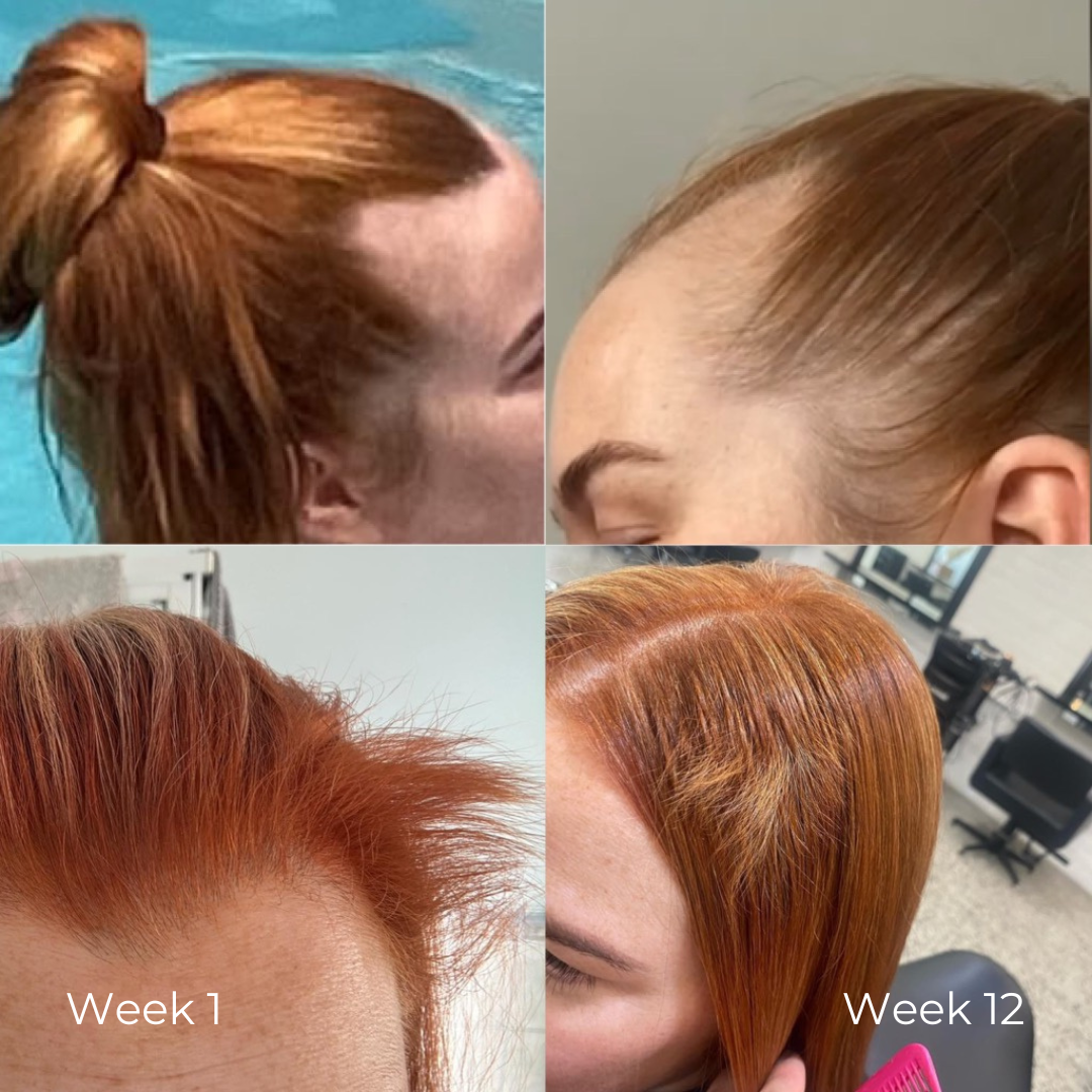 Hair Serum