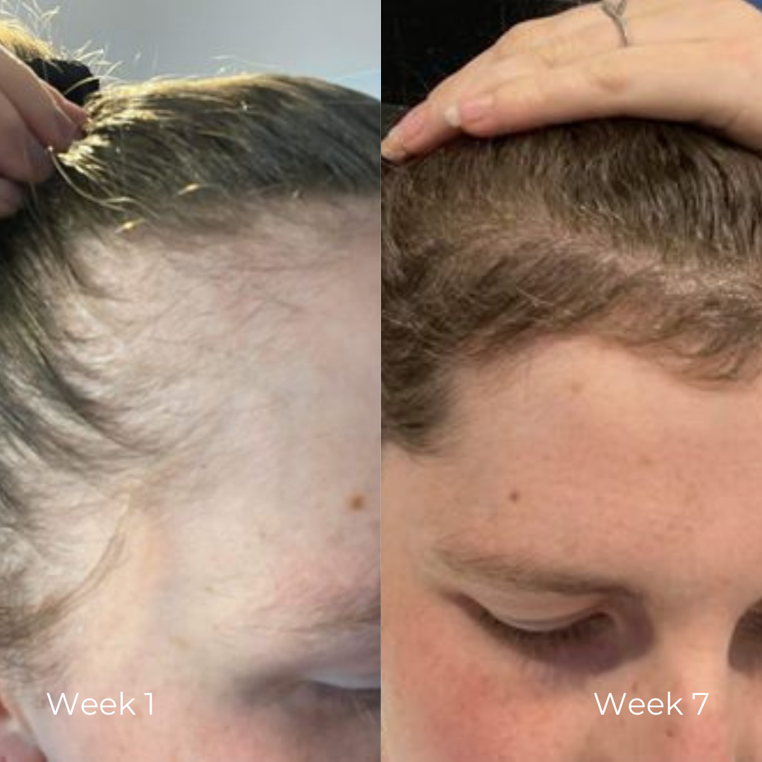 Hair Serum