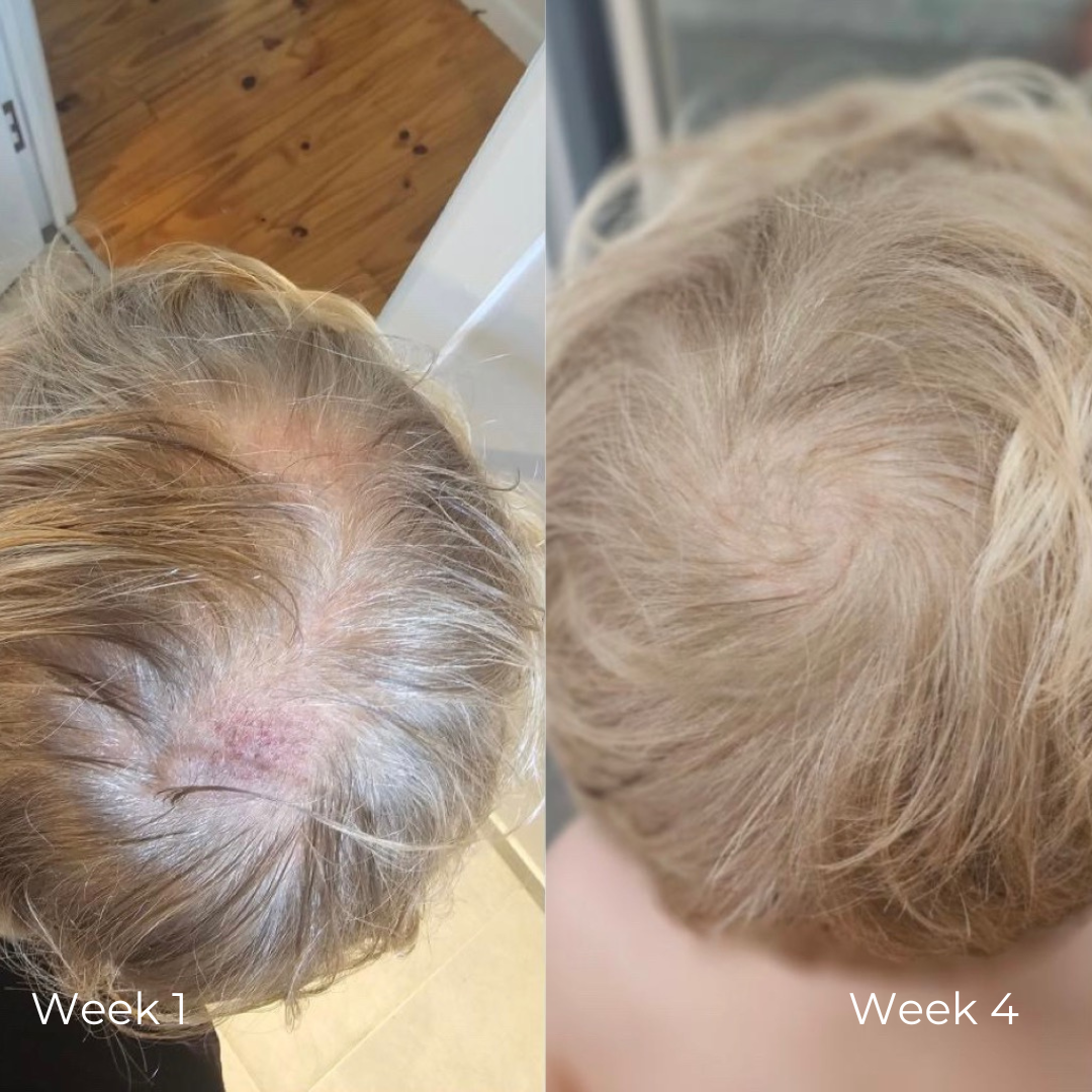 Hair Serum