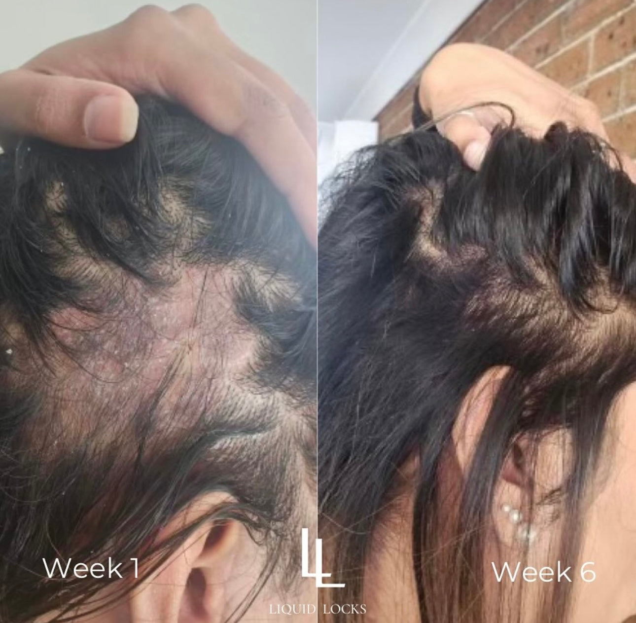 Hair Growth Serum