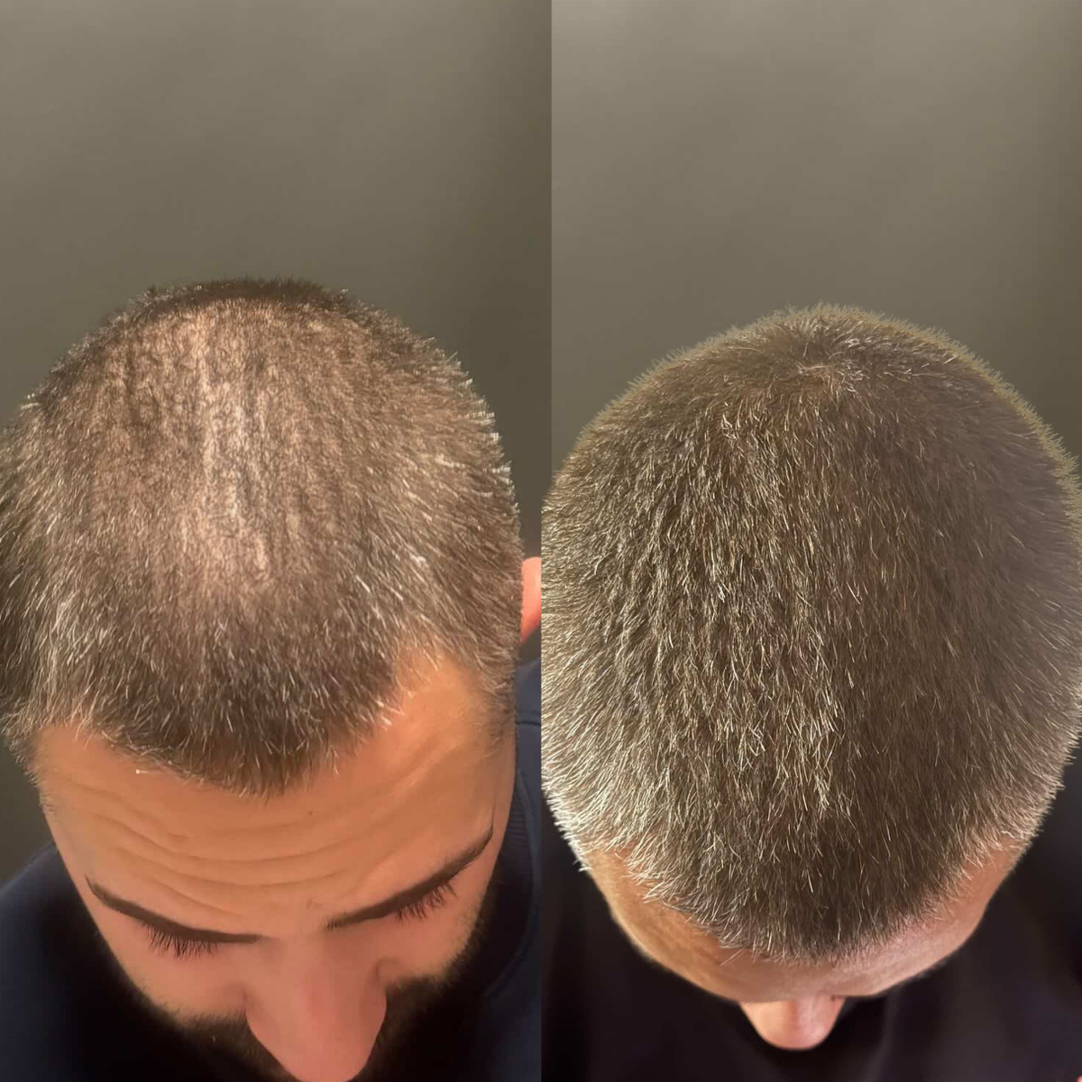 Hair Serum
