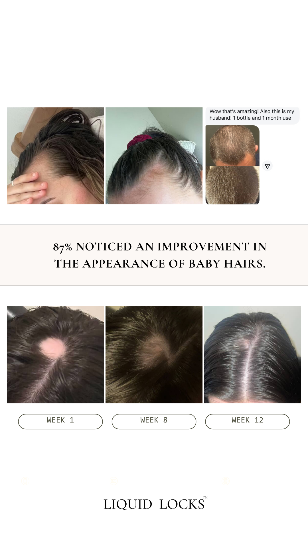 Hair Growth Serum 30ml