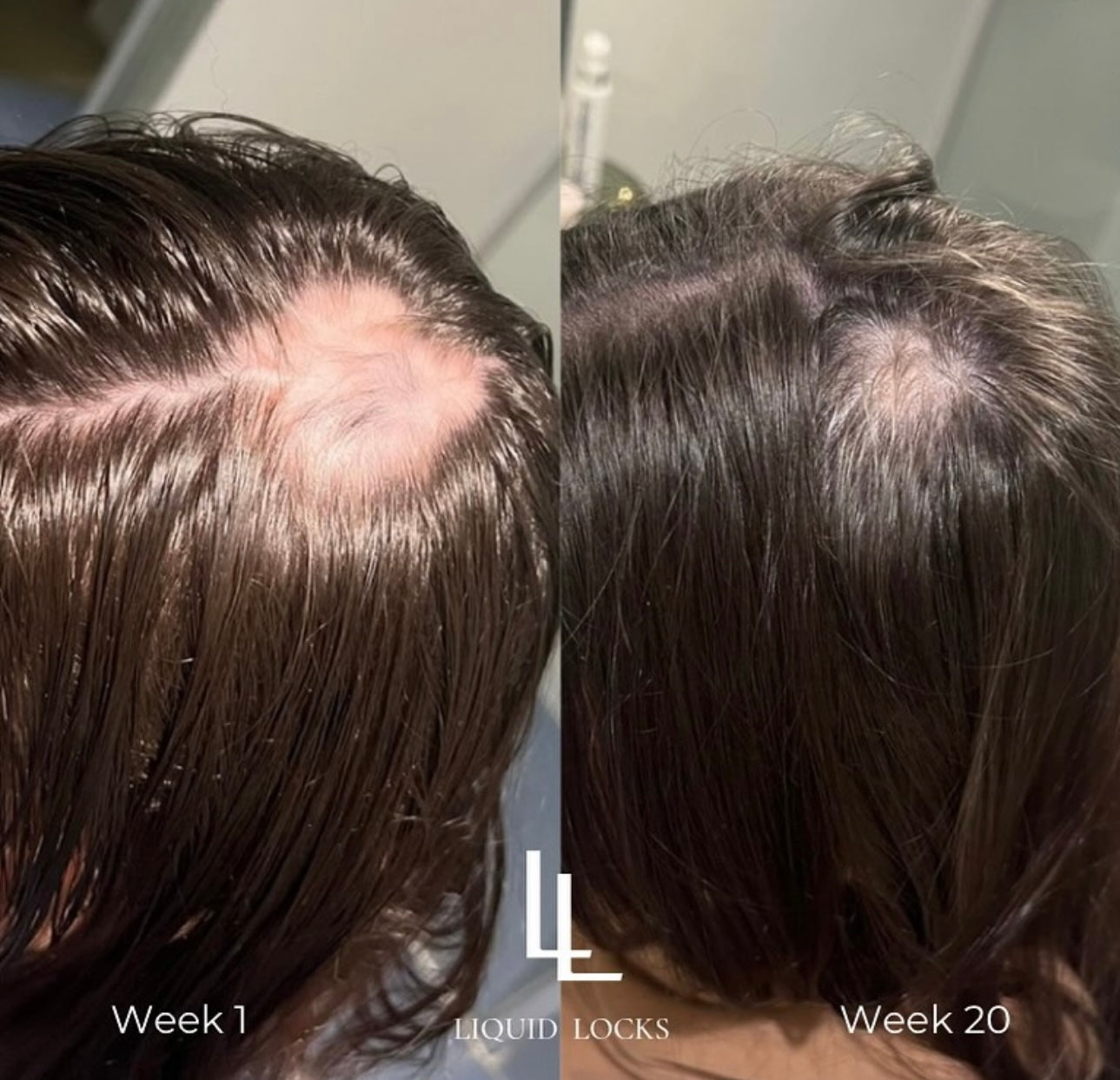 Hair Growth Serum