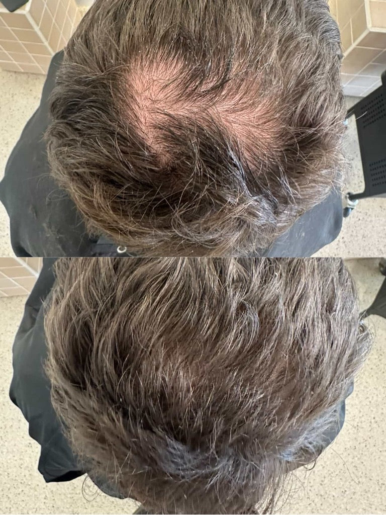 Hair Serum