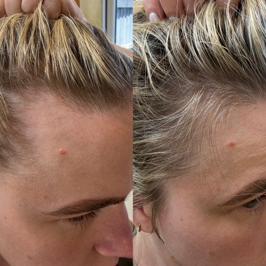 Hair Serum
