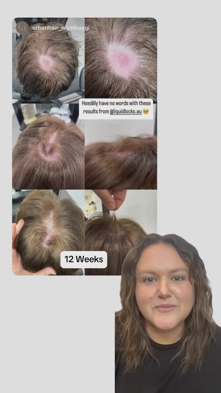 “Drs said her hair wouldn’t grow back” - Urban Hair Wonthaggi

#liquidlocks #hairgrowth #hairhealth #hairtok #australianmade